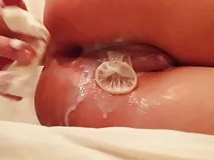 凱 · 派克
